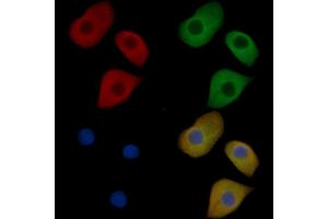 CXCR4 Mouse Monoclonal Antibody staining Hela cells by IF/ICC.