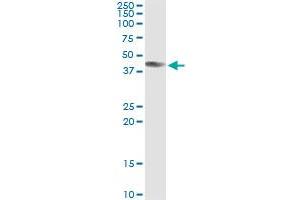 Immunoprecipitation of ART3 transfected lysate using anti-ART3 monoclonal antibody and Protein A Magnetic Bead , and immunoblotted with ART3 MaxPab rabbit polyclonal antibody. (ART3 antibody  (AA 29-138))