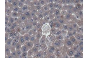 VWF antibody  (AA 1498-1665)
