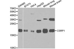Western blot analysis of various cell lines, using CSRP1 antibody. (CSRP1 antibody)