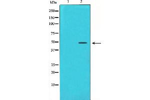 Western blot analysis on HeLa cell lysate using Cyclin E1 Antibody,The lane on the left is treated with the antigen-specific peptide. (Cyclin E1 antibody  (C-Term))