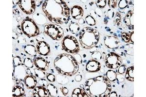 Immunohistochemical staining of paraffin-embedded Kidney tissue using anti-FAHD2Amouse monoclonal antibody. (FAHD2A antibody)