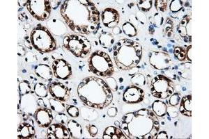 Immunohistochemical staining of paraffin-embedded Kidney tissue using anti-FAHD2Amouse monoclonal antibody.