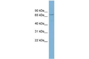 WB Suggested Anti-CNOT4 Antibody Titration: 0. (CNOT4 antibody  (Middle Region))