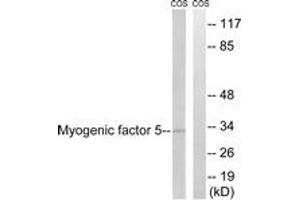 Western blot analysis of extracts from COS7 cells, using MYF5 (Ab-49) Antibody.