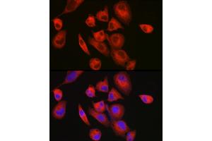 Immunofluorescence analysis of RD cells using MYH7/β-MHC Rabbit pAb (ABIN6129609, ABIN6144239, ABIN6144240 and ABIN6223471) at dilution of 1:150 (40x lens). (MYH7 antibody  (AA 1766-1935))