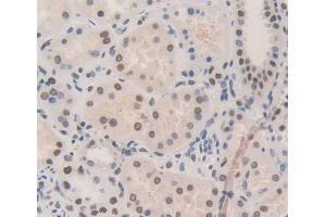Used in DAB staining on fromalin fixed paraffin- embedded Kidney tissue (NUP133 antibody  (AA 899-1091))