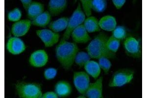 IF analysis of SRI using anti-SRI antibody (ABIN7599836).