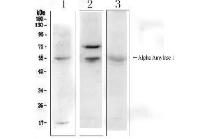 Western blot analysis of Alpha Amylase 1 using anti- Alpha Amylase 1 antibody . (AMY1A antibody  (N-Term))