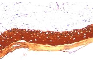 Formalin-fixed, paraffin-embedded human Skin stained with Cytokeratin, LMW Monoclonal Antibody (KRTL/1077). (Keratin 77 antibody)