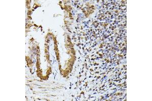 Immunohistochemistry of paraffin-embedded rat lung using HNRNPL antibody (ABIN6128048, ABIN6141915, ABIN6141917 and ABIN6216076) at dilution of 1:100 (40x lens). (HNRNPL antibody  (AA 282-589))