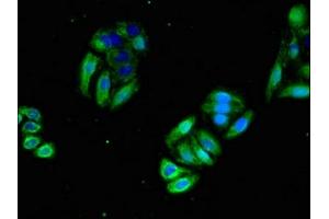 Immunofluorescent analysis of HepG2 cells using ABIN7154637 at dilution of 1:100 and Alexa Fluor 488-congugated AffiniPure Goat Anti-Rabbit IgG(H+L) (GTPase NRas antibody  (AA 1-186))