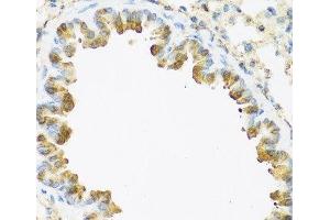 Immunohistochemistry of paraffin-embedded Mouse lung using S100A7 Polyclonal Antibody at dilution of 1:100 (40x lens). (S100A7 antibody)