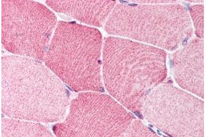 Human Skeletal Muscle (formalin-fixed, paraffin-embedded) stained with BRCC3 antibody ABIN213911 at 5 ug/ml followed by biotinylated goat anti-rabbit IgG secondary antibody ABIN481713, alkaline phosphatase-streptavidin and chromogen. (BRCC3 antibody  (N-Term))