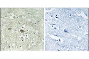 Immunohistochemistry analysis of paraffin-embedded human brain, using NDUFV3 Antibody. (NDUFV3 antibody  (AA 26-75))