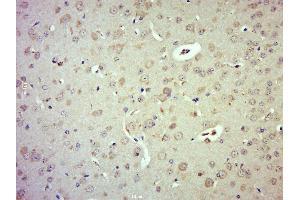 Paraformaldehyde-fixed, paraffin embedded mouse brain; Antigen retrieval by boiling in sodium citrate buffer (pH6. (LATS1 antibody  (pThr1079))