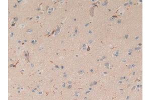 IHC-P analysis of Human Brain Tissue, with DAB staining. (Coronin 1a antibody  (AA 7-204))