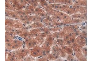 Detection of PYGL in Human Liver Tissue using Polyclonal Antibody to Glycogen Phosphorylase, Liver (PYGL) (PYGL antibody  (AA 370-538))
