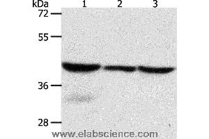 Western blot analysis of Mouse lung and human fetal lung tissue, hela cell, using CAPG Polyclonal Antibody at dilution of 1:700 (CAPG antibody)