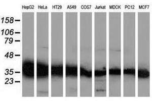 Image no. 11 for anti-UDP-Galactose-4-Epimerase (GALE) antibody (ABIN1498366)