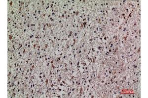 Immunohistochemistry (IHC) analysis of paraffin-embedded Human Brain, antibody was diluted at 1:100. (KEAP1 antibody  (Internal Region))