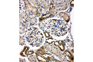 Immunohistochemistry (IHC) image for anti-WNT1 Inducible Signaling Pathway Protein 1 (WISP1) (AA 354-367), (C-Term) antibody (ABIN3043974)