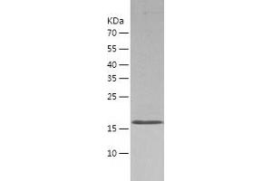 Western Blotting (WB) image for ASF1 Anti-Silencing Function 1 Homolog B (ASF1B) (AA 1-202) protein (His tag) (ABIN7289079) (ASF1B Protein (AA 1-202) (His tag))