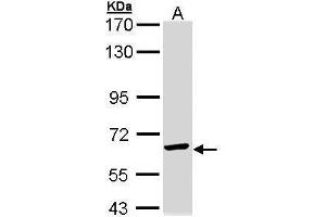 Western Blotting (WB) image for anti-Chaperonin Containing TCP1, Subunit 5 (Epsilon) (CCT5) antibody (ABIN2856739)