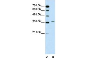 Western Blotting (WB) image for anti-Aminolevulinate Dehydratase (ALAD) antibody (ABIN2462445) (ALAD antibody)