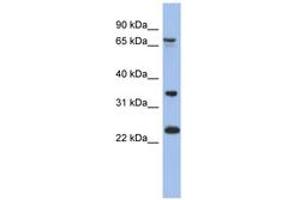 Image no. 1 for anti-TBC1 Domain Family, Member 25 (TBC1D25) (AA 179-228) antibody (ABIN6744062) (TBC1D25 antibody  (AA 179-228))