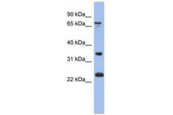 TBC1D25 anticorps  (AA 179-228)