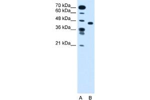 WB Suggested Anti-SLC35C1 Antibody Titration:  1. (SLC35C1 antibody  (N-Term))