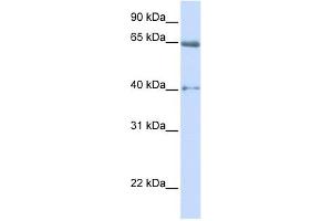 CACNB2 antibody used at 1 ug/ml to detect target protein. (CACNB2 antibody  (Middle Region))