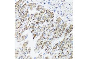 Immunohistochemistry of paraffin-embedded mouse stomach using TIMM10B antibody. (TIMM10B antibody  (AA 1-103))