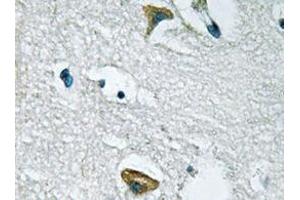 Immunohistochemistry analyzes of JAK3 antibody in paraffin-embedded human brain tissue. (JAK3 antibody)