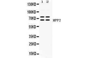 Western blot analysis of MPP2 expression in rat brain extract ( Lane 1) and mouse brain extract ( Lane 2).