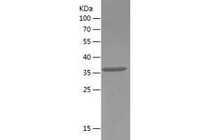 Western Blotting (WB) image for Transcription Factor 4 (TCF4) (AA 399-503) protein (His-IF2DI Tag) (ABIN7125438) (TCF4 Protein (AA 399-503) (His-IF2DI Tag))