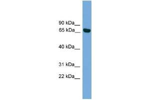 WB Suggested Anti-PRKCI Antibody Titration: 0. (PKC iota antibody  (Middle Region))