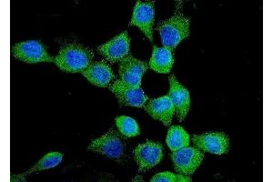 IF analysis of EGFR using anti-EGFR antibody (ABIN7599622).