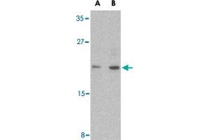 Western blot analysis of CASP6 in MCF-7 cell lysate with CASP6 polyclonal antibody  at (A) 1 and (B) 2 ug/mL . (Caspase 6 antibody  (Internal Region))