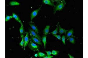 Immunofluorescent analysis of Hela cells using ABIN7159984 at dilution of 1:100 and Alexa Fluor 488-congugated AffiniPure Goat Anti-Rabbit IgG(H+L) (MAPK12 antibody  (AA 314-367))