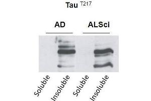 Western blot detection of insoluble phospho-Tau protein using the anti-Tau (Thr-217) antibody in samples isolated from patients with a neurodegenerative disease (Amyotropic lateral sclerosis, ALS or Alzheimer’s disease, AD (tau antibody  (pThr217))