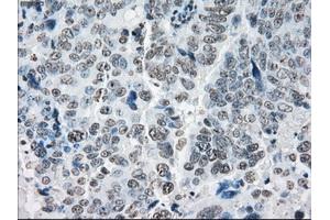 Immunohistochemical staining of paraffin-embedded colon tissue using anti-PRKYmouse monoclonal antibody. (PRKY antibody)