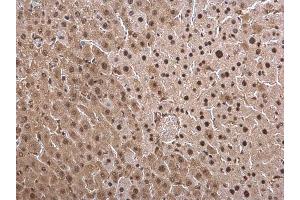 IHC-P Image PSMB8 antibody [N2C3] detects PSMB8 protein at cytosol and nucleus on mouse liver by immunohistochemical analysis.