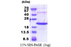 SDS-PAGE (SDS) image for Triggering Receptor Expressed On Myeloid Cells 2 (TREM2) (AA 19-161) protein (His tag) (ABIN5853402)