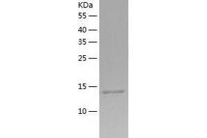 Western Blotting (WB) image for SCP2 Sterol-Binding Domain Containing 1 (SCP2D1) (AA 1-156) protein (His tag) (ABIN7289317) (SCP2D1 Protein (AA 1-156) (His tag))
