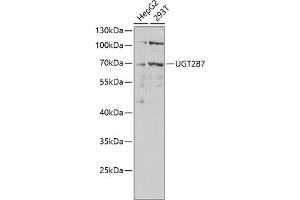 Western blot analysis of extracts of various cell lines, using UGT2B7 antibody (ABIN6132908, ABIN6149903, ABIN6149904 and ABIN6218790) at 1:1000 dilution. (UGT2B7 antibody  (AA 25-351))