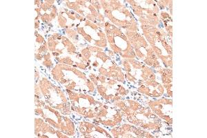 Immunohistochemistry of paraffin-embedded human stomach using HMG antibody (635) at dilution of 1:100 (40x lens). (HMGA1 antibody  (AA 1-100))