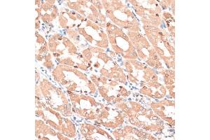 Immunohistochemistry of paraffin-embedded human stomach using HMG antibody (635) at dilution of 1:100 (40x lens). (HMGA1 antibody  (AA 1-100))