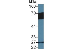 Detection of GP6 in Human Serum using Polyclonal Antibody to Glycoprotein VI (GP6) (GP6 antibody  (AA 86-231))